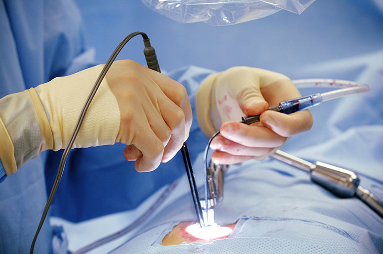 Minimal Invasive Heart Bypass Surgery in Delhi | Dr. S. K. Sinha